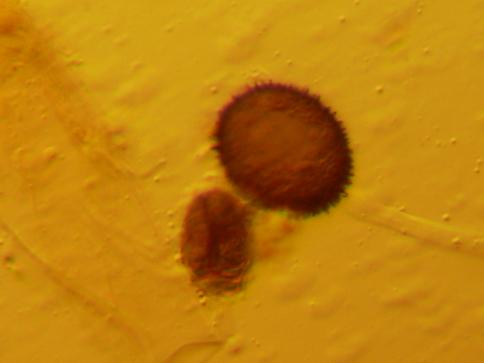 Aleurodiscus amorphus (Fr.)Schroeter